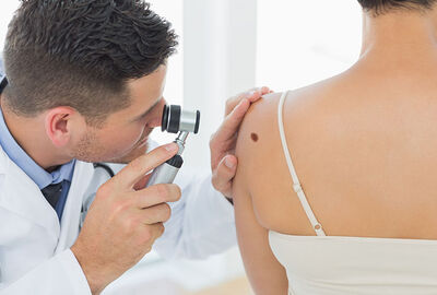 طبيب أمراض جلدية يحدد الأعراض التي تشير إلى سرطان الجلد