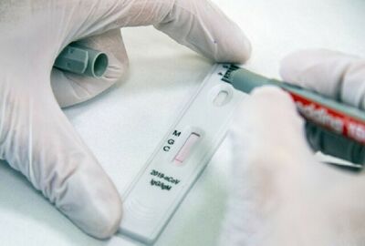 روسيا.. ابتكار نظام اختبار سريع لكشف الإصابة بالفيروس التاجي