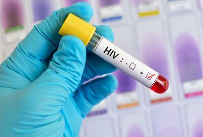 تقرير: انخفاض عدد الإصابات بفيروس نقص المناعة في روسيا