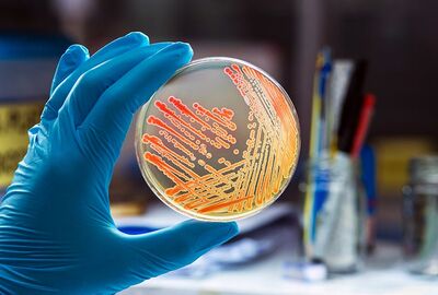 علماء جامعة بطرسبورغ التقنية يبتكرون هيدروجيلا مضادا للبكتيريا وصديقا للبيئة