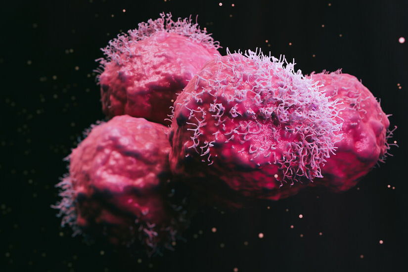 علماء يحددون طفرة تجعل سرطان البروستات عدوانيا