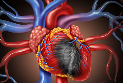في تجربة واعدة.. عقار فموي يخفض مؤشرات أمراض القلب بنسبة مفاجئة!