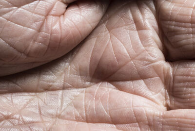العلماء يطورون جلدا شبيها بالجلد البشري أكثر من أي وقت مضى