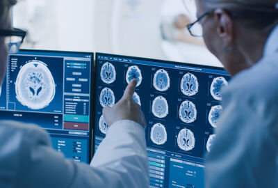 علاج تجريبي يحارب سرطان الدماغ غير القابل للعلاج بفيروس الهربس المعدل