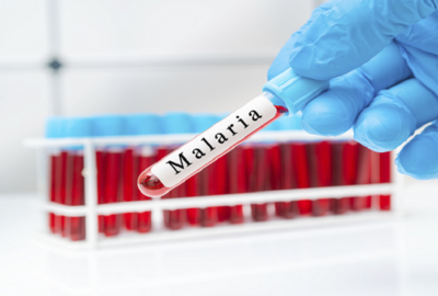 الأولى في إفريقيا!.. شركة كينية تحصل على موافقة منظمة الصحة العالمية على عقار للملاريا