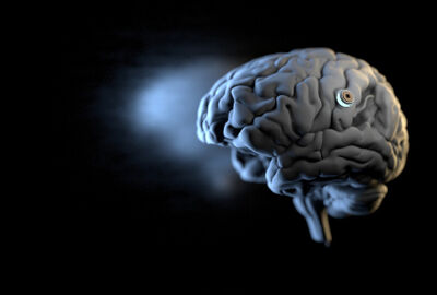 جهاز يزرع في الدماغ يخلص أمريكية من الوسواس القهري والصرع