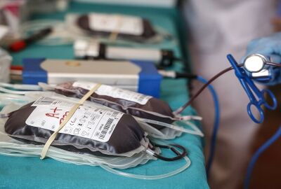 روسيا.. ابتكار مادة ماصة عامة لتنقية الدم